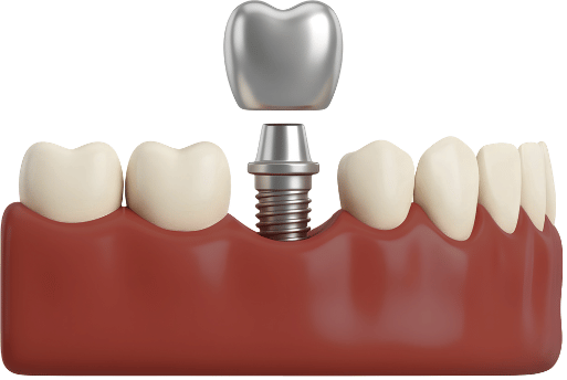Surgical Procedure